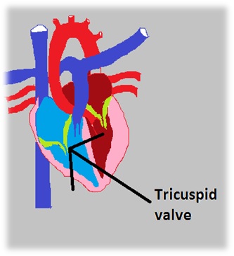 Tricuspid valve abnormalities